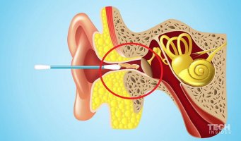 샤워 후 '면봉'으로 귀 파면 절대 안 되는 이유