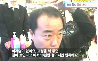 [정수리탈모] 탈모고민 정수리탈모 '탈모교정술'로 풍성하고 젊어 보이게 교정하였습니다