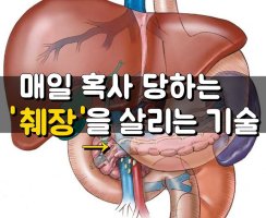 매일 혹사 당하는 췌장을 살리는 기술