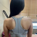 양이멍이 | 공덕 다이어트 주사- 안빠지는 팔뚝에 딱! 제로팻주사 -8회차 후기