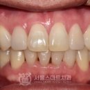 스마트라인치과기공소 이미지