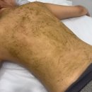 월드크리닝 해운대지사 | 해운대 등드름관리 • 라데끄랩 슈가링 부산지사 뉴 알라딘 필링 저통증필링 추천후기