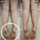 바름 | 하체 순환마사지로 붓기 완전 정복 후기 바름뷰티연구소 원주점
