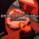 첨단피부관리 광주레이저토닝 화이트태닝