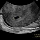 르샘여성의원 이미지