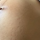 소소한 이슈가 있는 로컬+대병다니는 산모는 임신기간 비용 총정리(임신출산바우처 과연 남았을까...