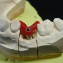 홍익 치과기공소 이미지