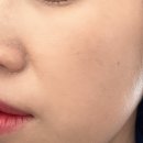 황금피부샾