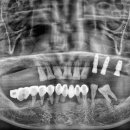 함양치과기공소 이미지