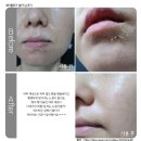 [새살필] 자극과 통증은 NO! 해초필링/약초필링 홈케어 후기