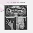 우리바른치과의원 운정점 | 운정어린이치과 겨울방학 초등학생 교정 시기, 치아 상태에 따른 교정 방법
