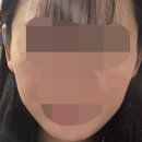 유노성형외과의원 네이버블로그