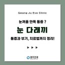 눈꺼풀 안쪽 통증? 눈 다래끼 종류와 증상, 치료법까지 정리! 🤦‍♀️ 이미지