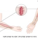 탑스핀골프 이미지