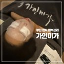 생활 경락 | 부천 피부관리 가인미가 부천상동역점 피부샵 웨딩관리 얼굴축소경락 후기