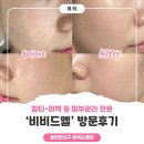 비비드 | [인천 검단] 당하동 피부관리, 색소케어, 기미제거 전문 ‘비비드엘’ 후기