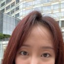 디비성형외과의원 | 쌍꺼풀재수술 + 눈두덩이 지방이식 비용 후기 2주~한달 사진