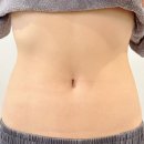 사하구-75 | 부산 사하구 다대포 복부관리 잘하는 곳, 리움에스테틱