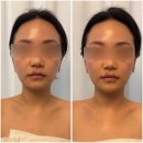 엠니트