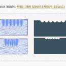 인트라] [라식 / 라식수술] 인트라라식 그 우수성에 대하여 이미지