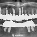 좋은솜씨죽전치과의원 이미지
