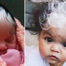Baby Born with White Hair-Causes & Treatment 이미지