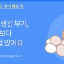 아이뷰성형외과 네이버블로그