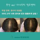 다나침 | 두달만에 머리가 났어요 !! 50대고객 사하구 다나두피에서 탈모자 살림!!!