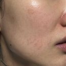 (주)엔피씨 | 도미나기미크림 후기 크림 &amp; 기미에 좋은팩 결과는?