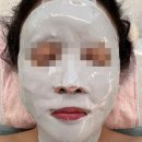 울산에스테틱 화봉동 피부샵 뷰티블레스 바이더퀄리티 엑소좀 후기