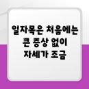 동탄리뉴본한의원 | 동탄한의원 일자목은 처음에는 큰 증상 없이 자세가 조금