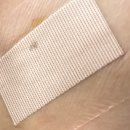 덜아픈세상 | 맘모톰 시술 후기 (밴드 알레르기/접촉성 피부염🤕)