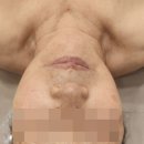 화신노블레스3차 | 평택피부관리 노화에 관리하기 좋았던 에스제이 파메스테틱 피부연구소 방문후기