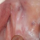 마노메디칼 이미지