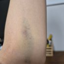 허스템의원 이미지