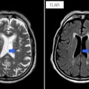수원-1180 이미지