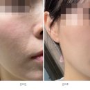 더윰:테라피