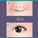 스펀지성형외과의원 이미지