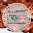 김콘택트렌즈 이미지