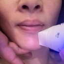 향남 피부관리 모공,물방울재생,복부관리 후기 365왁싱&amp;뷰티