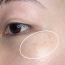유코스메틱 | 얼굴 눈밑 기미 케어 리유 나이트루틴 잡티크림 사용법 및 후기