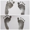 쌍둥이 제왕절개 입원_부산좋은문화병원