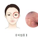 작은
