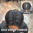20 | 두피페인팅 후기 의정부 20대 원형탈모 고객님 흑채 대신 선택한 이유