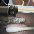 아산안과의원 | ✨ 아산 탕정김안과 솔직후기 (내돈내산)