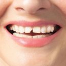 메디스메디칼 이미지