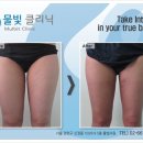 날씬의원 이미지