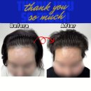 디플러스헤어