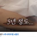 메디F | 주사피부염 5년된 증상 5개월만에 50% 없앤 후기(c.f.브이빔, 제네시스, 엑셀브이 레이저)