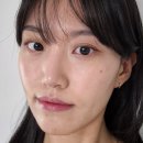 발산역피부과 튠페이스 리프팅 풀페이스 후기!